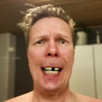Jukka Rasila hampaat – totuus kuvan takana