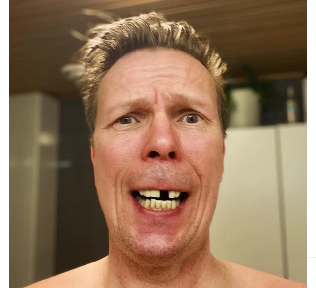 Jukka Rasila hampaat – totuus kuvan takana